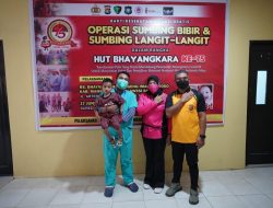 Sambut Hari Bhayangkara Ke-75, Polda Sulbar Gelar Operasi Bibir Sumbing